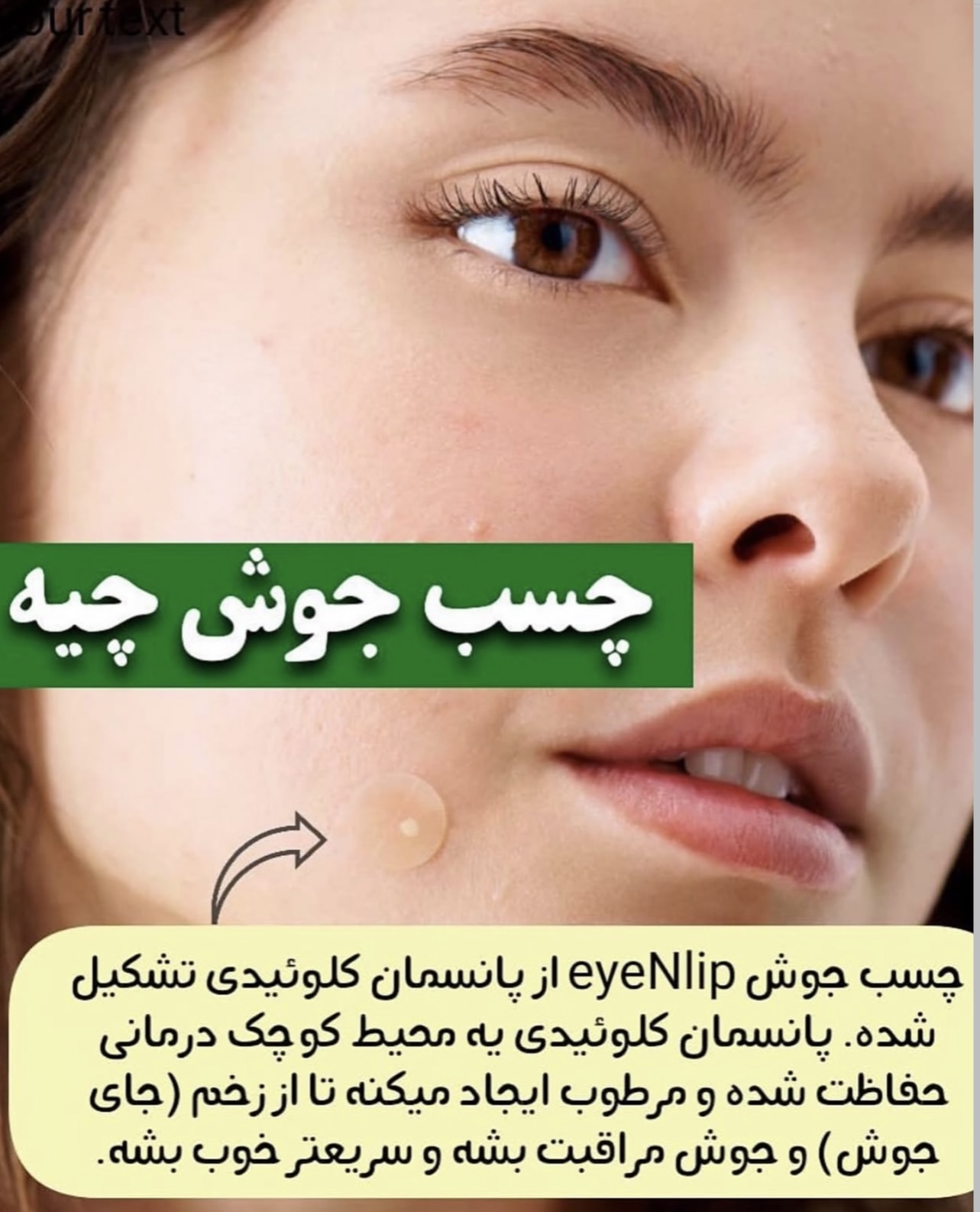 چسب جوش اورژانسی‼️