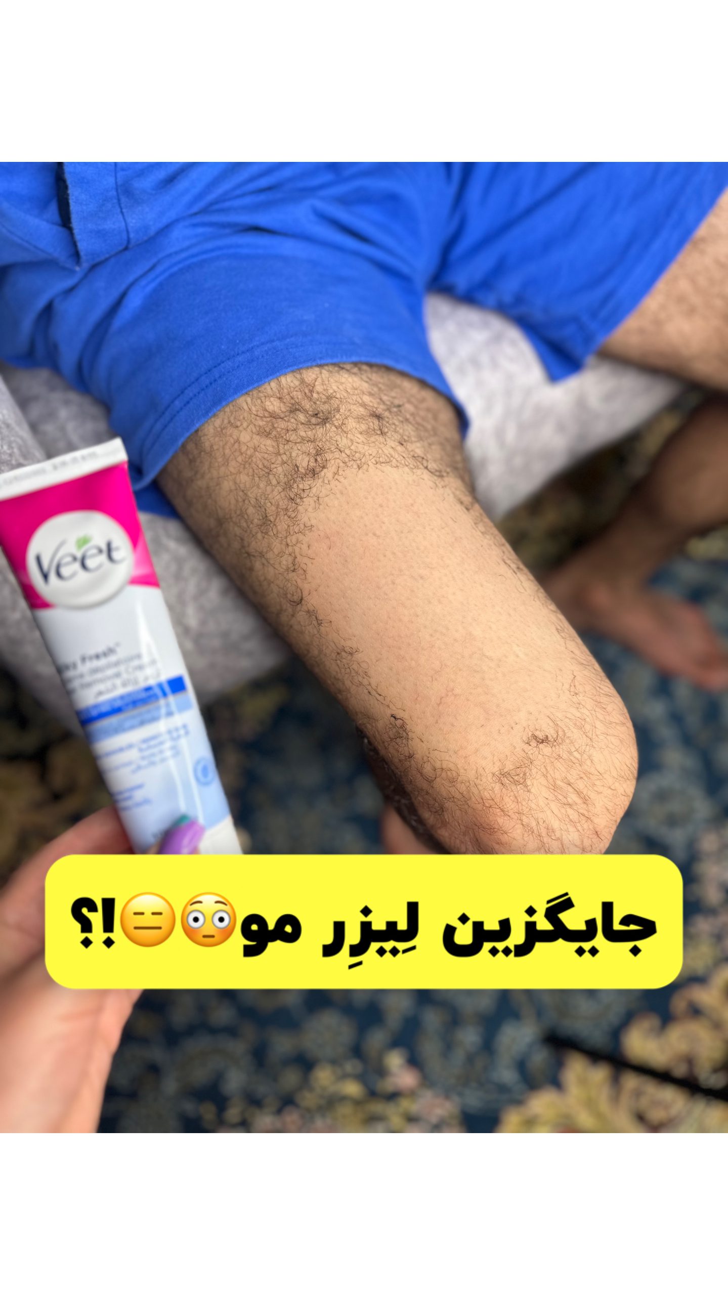 کرم موبر ویت 