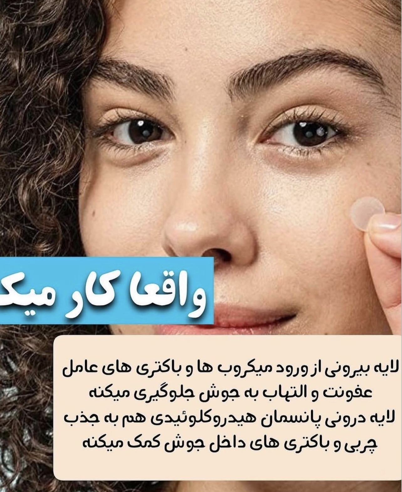 چسب ضد جوش
