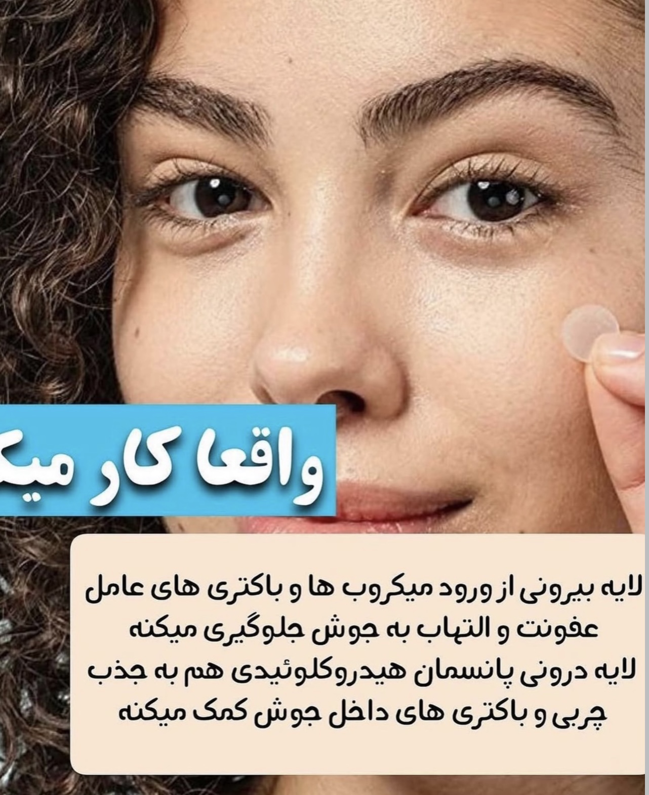 چسب جوش اورژانسی‼️