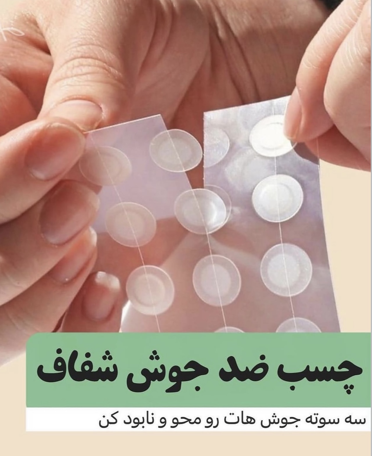 چسب جوش اورژانسی‼️