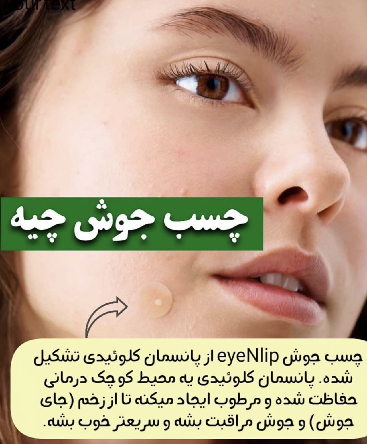 چسب ضد جوش