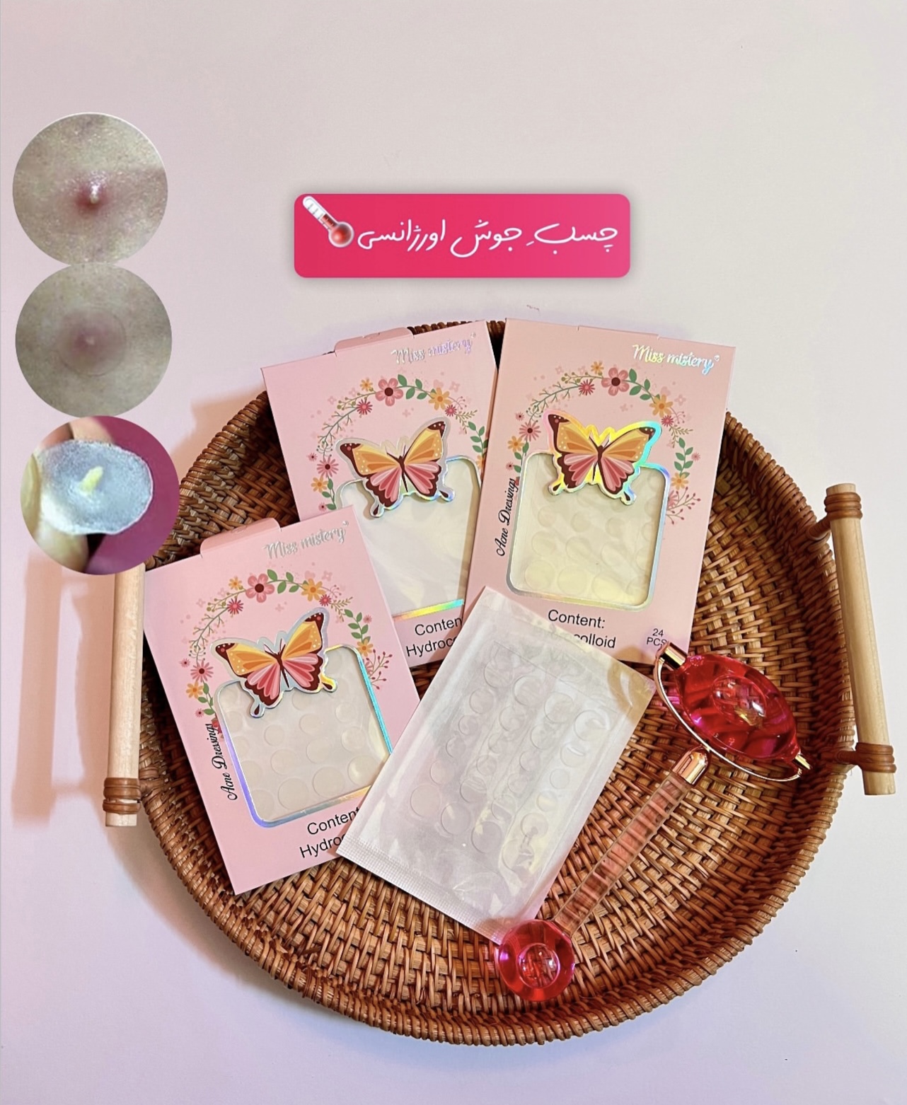 چسب جوش اورژانسی‼️