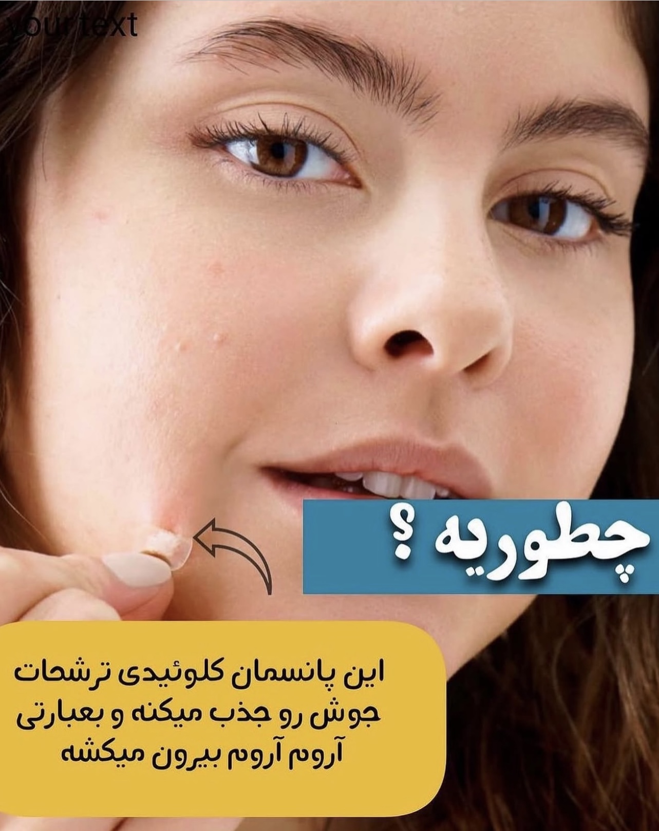 چسب جوش اورژانسی‼️