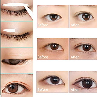 چسب لیفت پلک